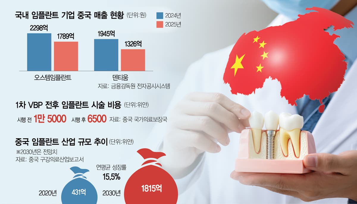 중국 임플란트 2차 입찰, 이번엔 가격만 보지 않는다